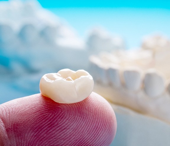 Tooth-colored dental crown resting on fingertip in front of model jaw