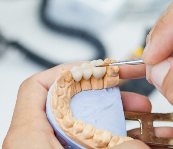 a dental lab technician crafting a bridge