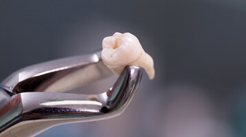 a tooth in a pair of forceps