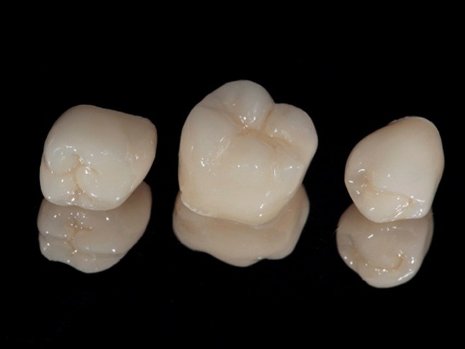 porcelain dental crowns