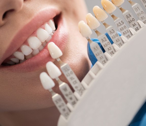 a dentist matching the shade of a patient’s teeth