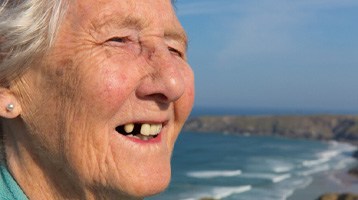 An elderly lady with missing teeth