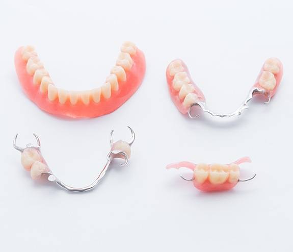 Four types of dentures