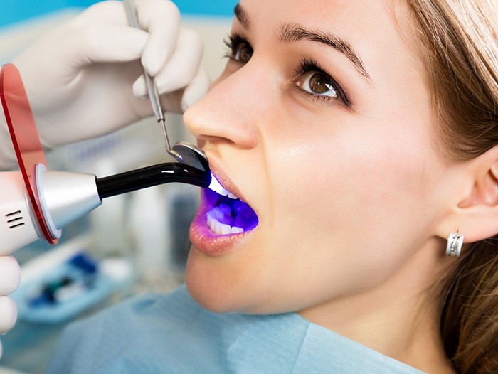 Woman’s tooth-colored filling being hardened with UV light