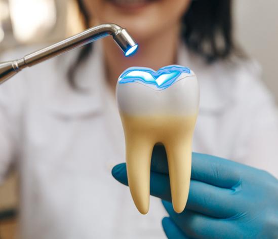 Dentist demonstrating filling technique with large model tooth