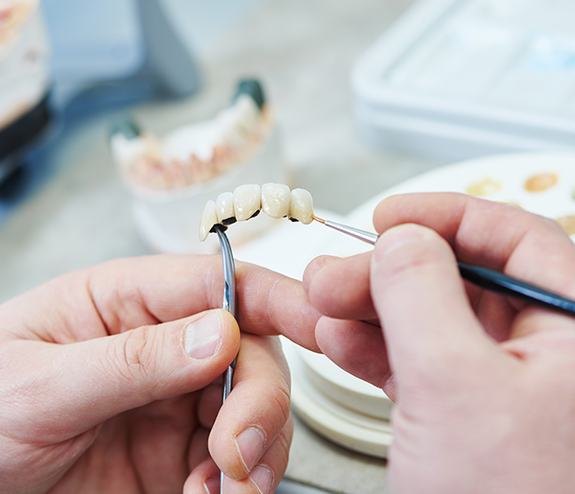 Dental bridge being crafted in dental lab