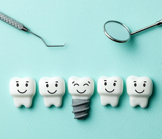 Illustration of dental implants in Longmont