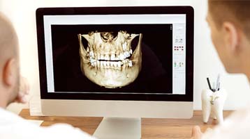 Dentists looking at image from 3D CT cone beam scanner in Longmont