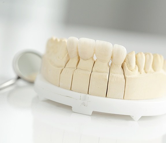 Model smile with dental crown restoration