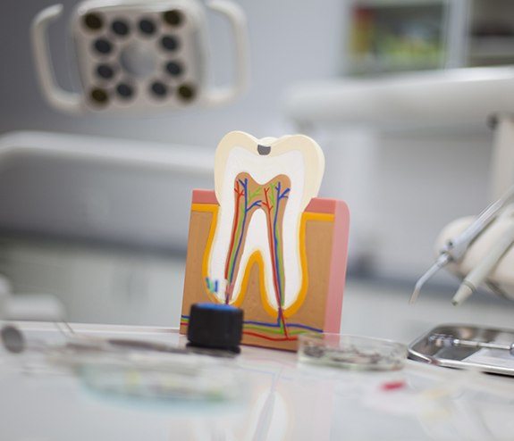 Model of the inside of a tooth before root canal therapy