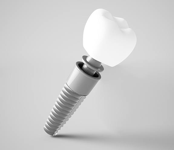 Animated parts of dental implant supported replacement tooth