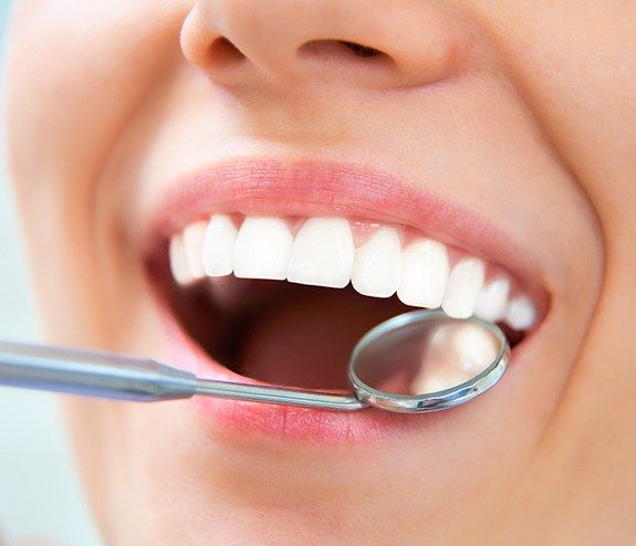 Dentist examining a patient's smile after tooth colored filling