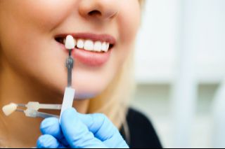 Woman having the shade of her teeth matched