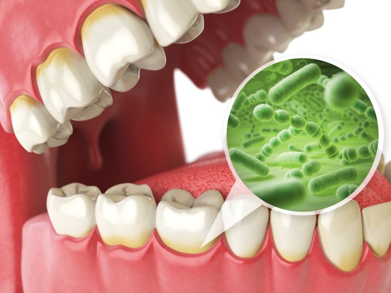 an image of bacteria found in gum disease