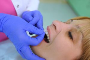 A person reclined while a dentist with blue gloves places a veneer on their front tooth