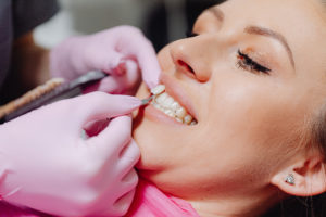 Woman having a veneer applied to a tooth